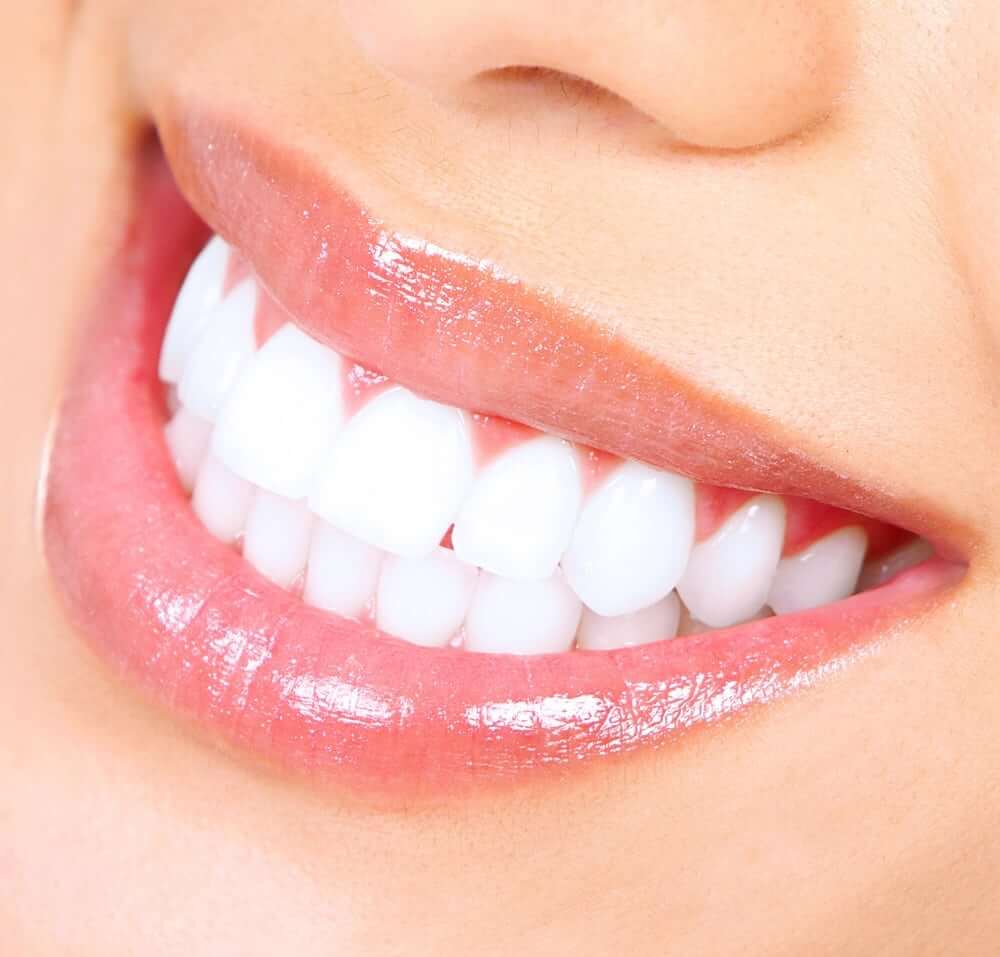 Image of Cleaner smile whitening strips
