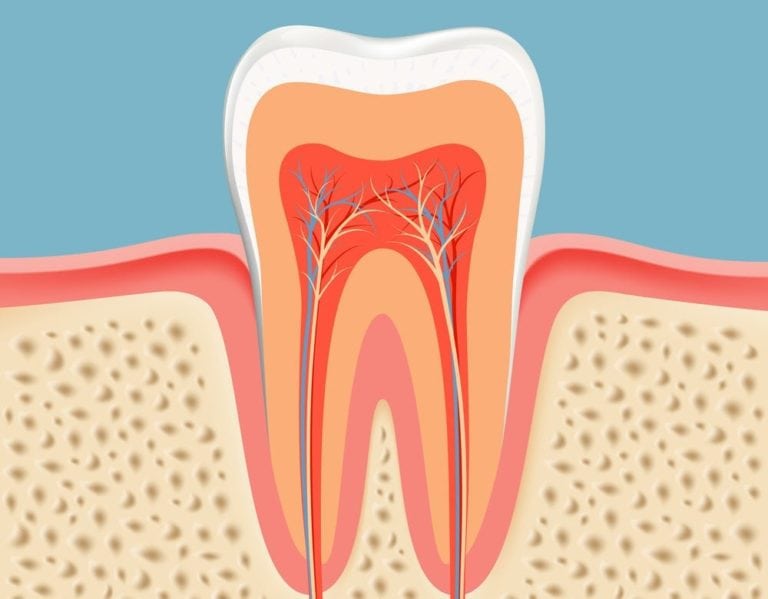 Image of teeth root canal treatment