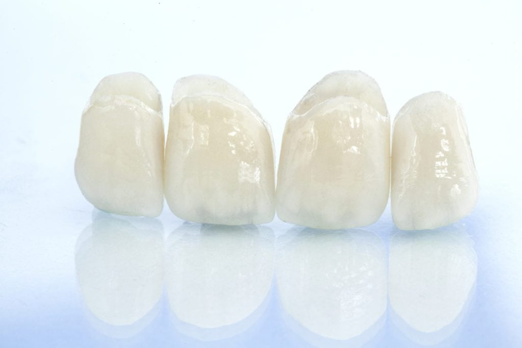 Image of Tooth decay can wreak havoc on your smile