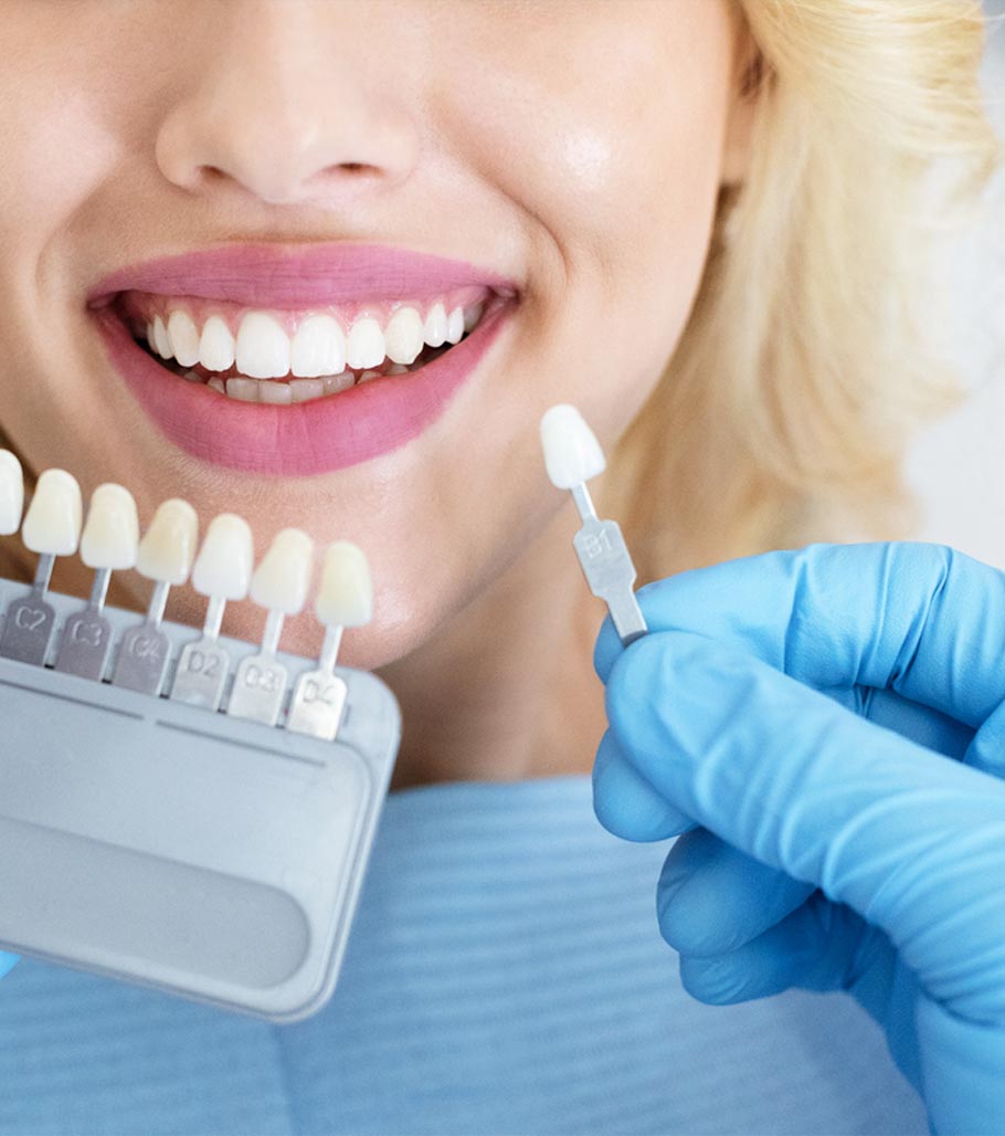 Stock image of a dentist checking right shade of teeth with that of female patient teeth for teeth whitening or implants