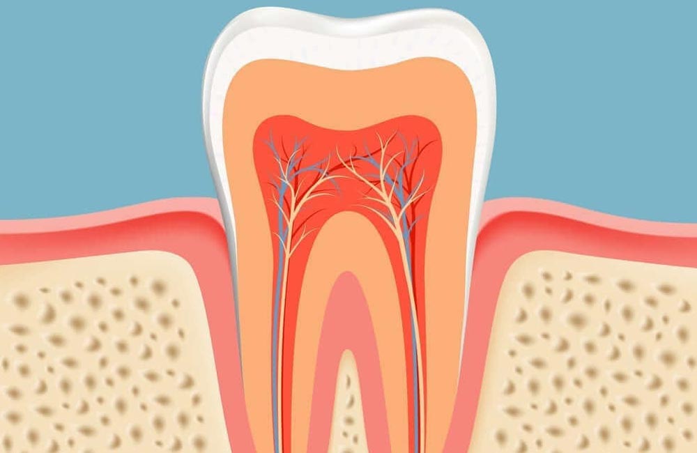 Root Canals Image