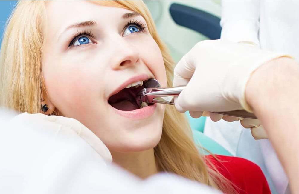 Tooth Extraction Image