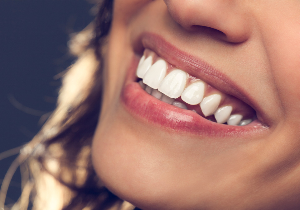 Stock image of a smiling female focusing on her teeth