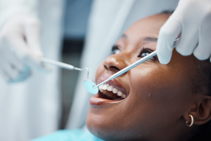 Image of a black woman mid dental cleaning as the featured image for "How Often Should You Undergo Professional Dental Cleaning?"