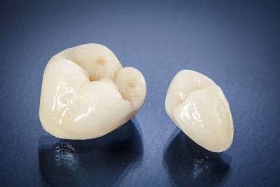 Image of Dental Crowns Repair Damaged Or Broken Teeth